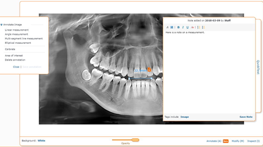 dental imaging