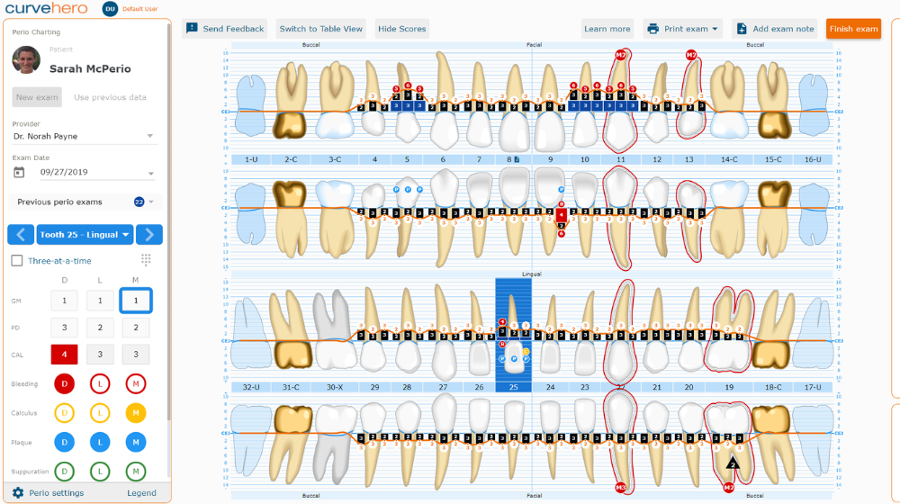 curve dental charting