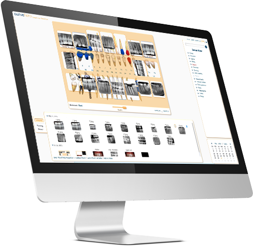 Curve Dental - Complete Cloud-Based Dental Practice Management